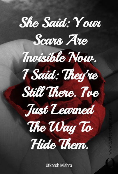 She Said: Your Scars Are Invisible Now.
I Said: They're Still There. I've Just Learned The Way To Hide Them.